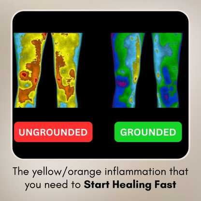 Grounding Nest Sciatica Relief Mat